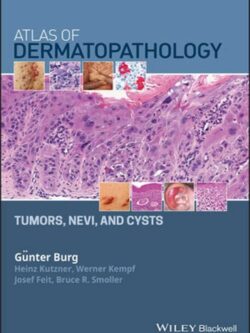 Atlas of Dermatopathology: Tumors, Nevi, and Cysts