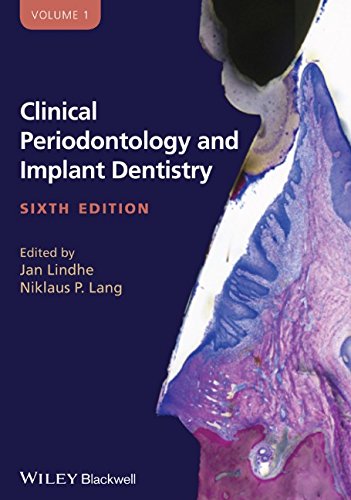 Clinical Periodontology and Implant Dentistry, 2 Volume Set (6th edition)