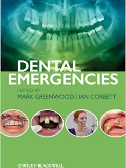 Dental Emergencies