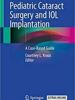 Pediatric Cataract Surgery and IOL Implantation: A Case-Based Guide