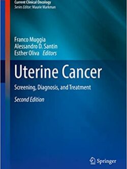 Uterine Cancer: Screening, Diagnosis, and Treatment (2nd Edition)