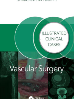 Vascular Surgery: Illustrated Clinical Cases – PDF