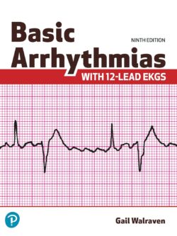 Basic Arrhythmias With 12-Lead EKGs (9th Edition) – eBook PDF